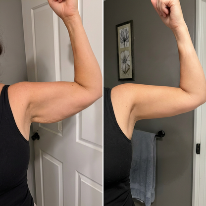 Manchons - Armplify par Novalie