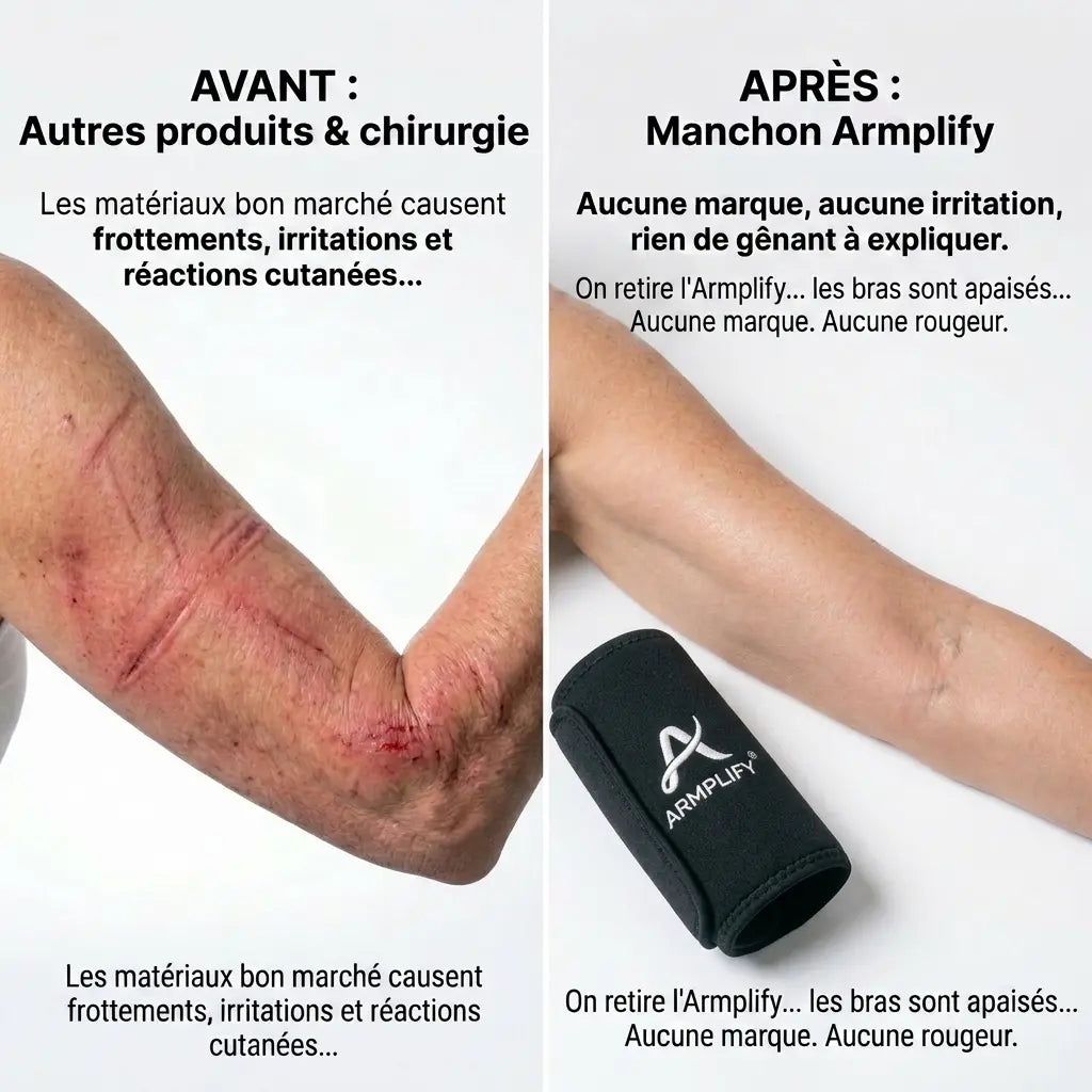 Manchons - Armplify par Novalie