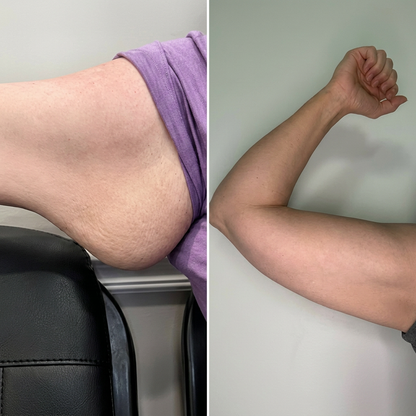Manchons - Armplify par Novalie